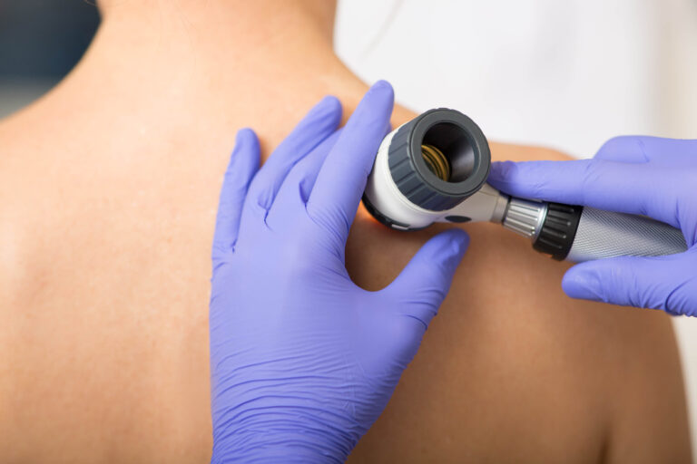 Skin Cancer Screenings Lynchburg Dermatologist Offers Screenings