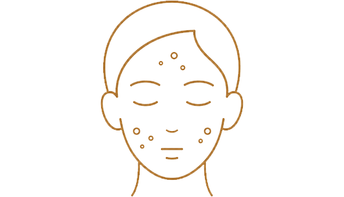 acne-icon
