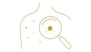 moles-icon