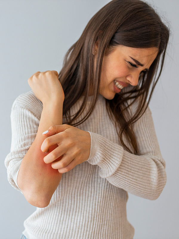 psoriasis-2