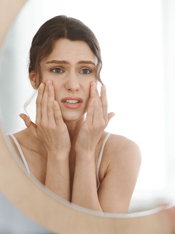 rosacea-1