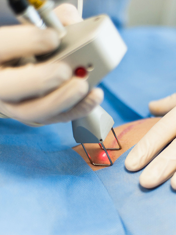scar-treatment1